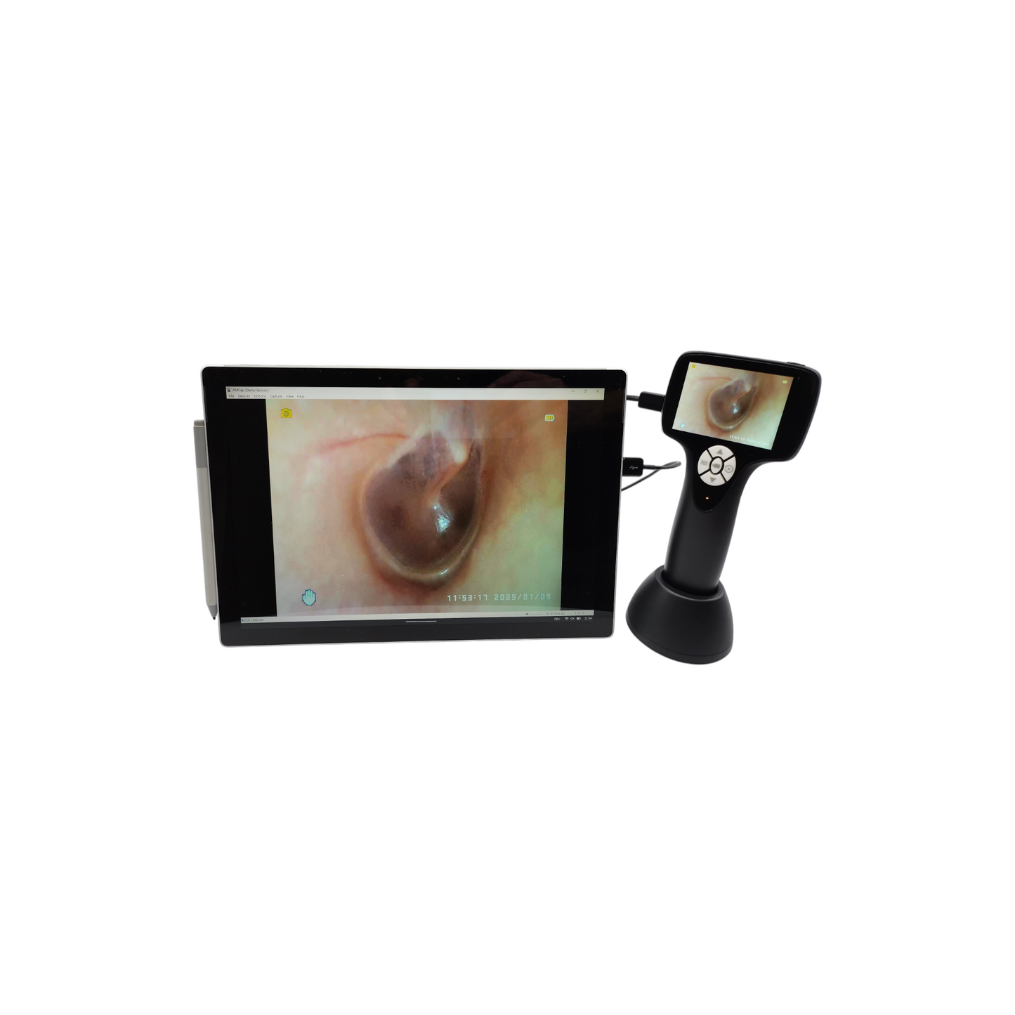 MultiScope - The Digital Naso-Laryngo-Otoscope