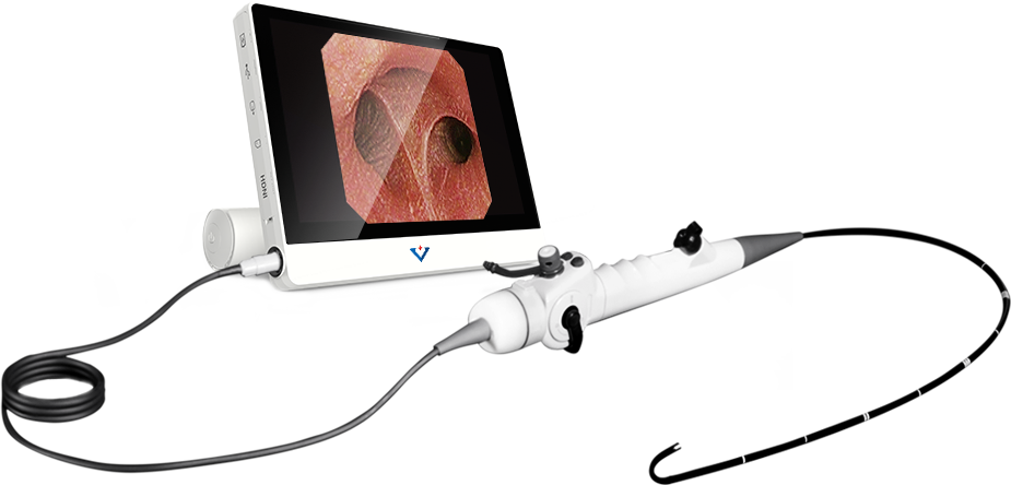 Cystoscope, flexible, 5,2 mm